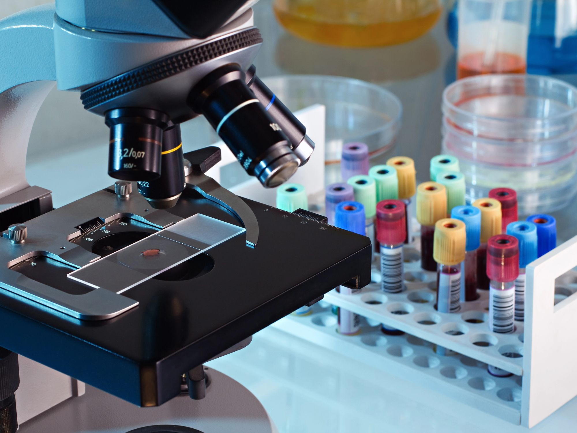 Щепотка бора, капля молибдена: ищем европейские присадки на российских маркетплейсах